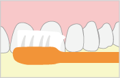 ブラッシング指導